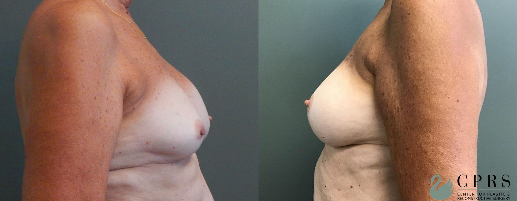 Before photo - Angle 2