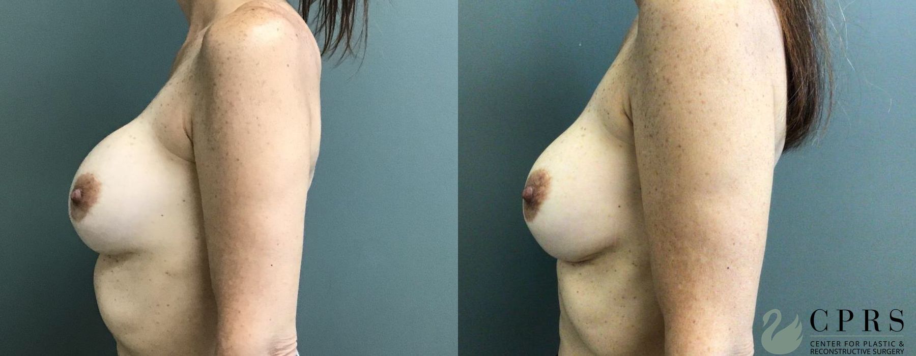 Before photo - Angle 2