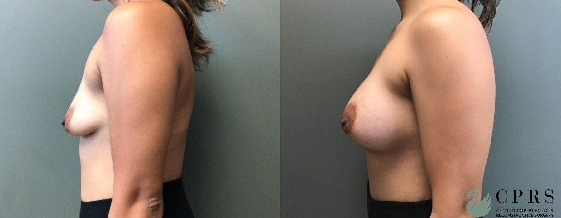 Before photo - Angle 3