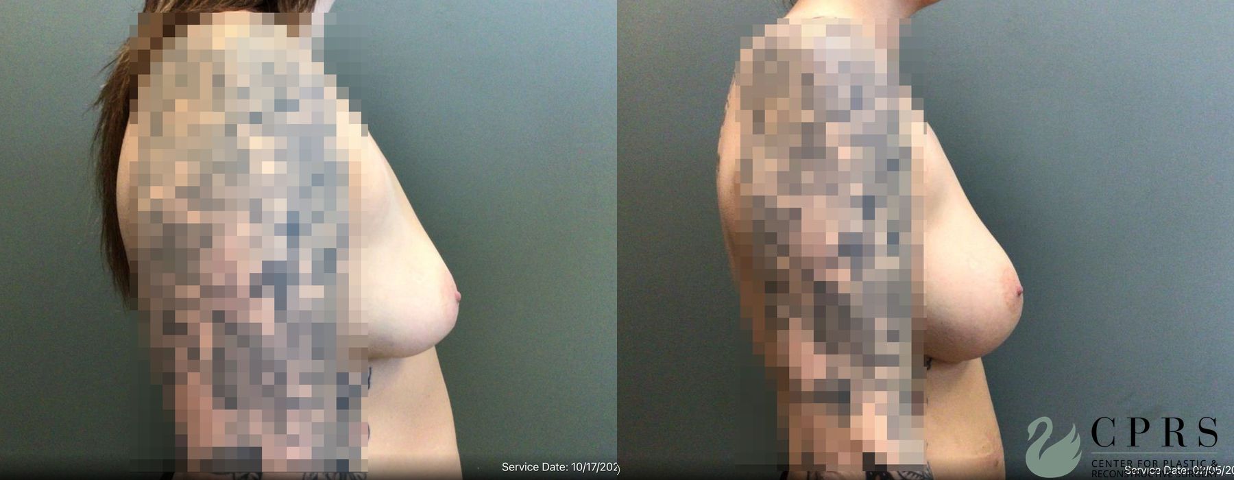 Before photo - Angle 3