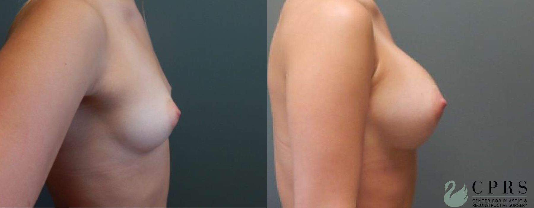 Before photo - Angle 3