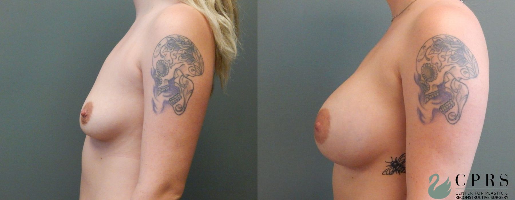 Before photo - Angle 3