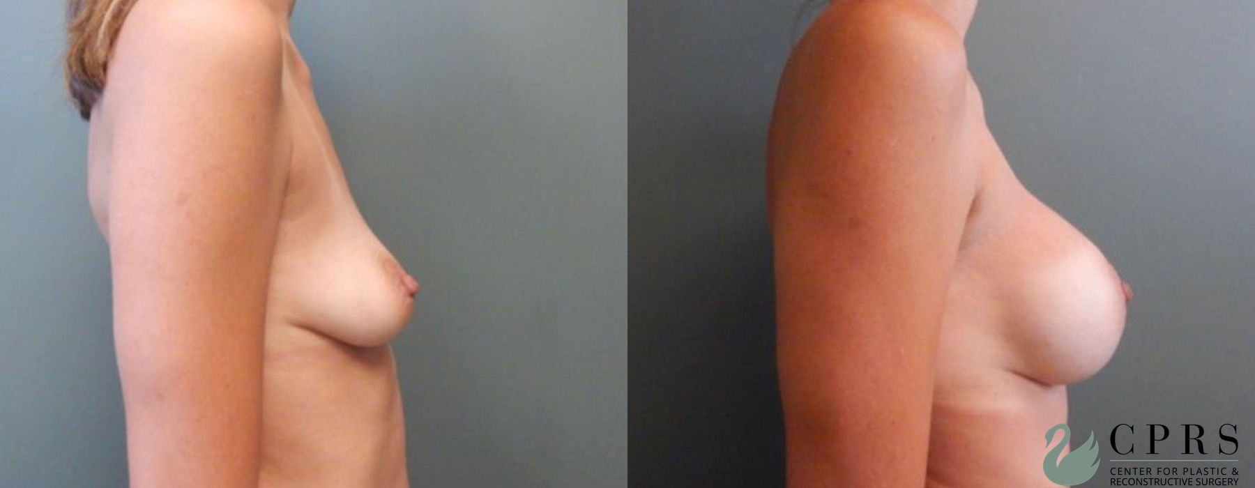 Before photo - Angle 3