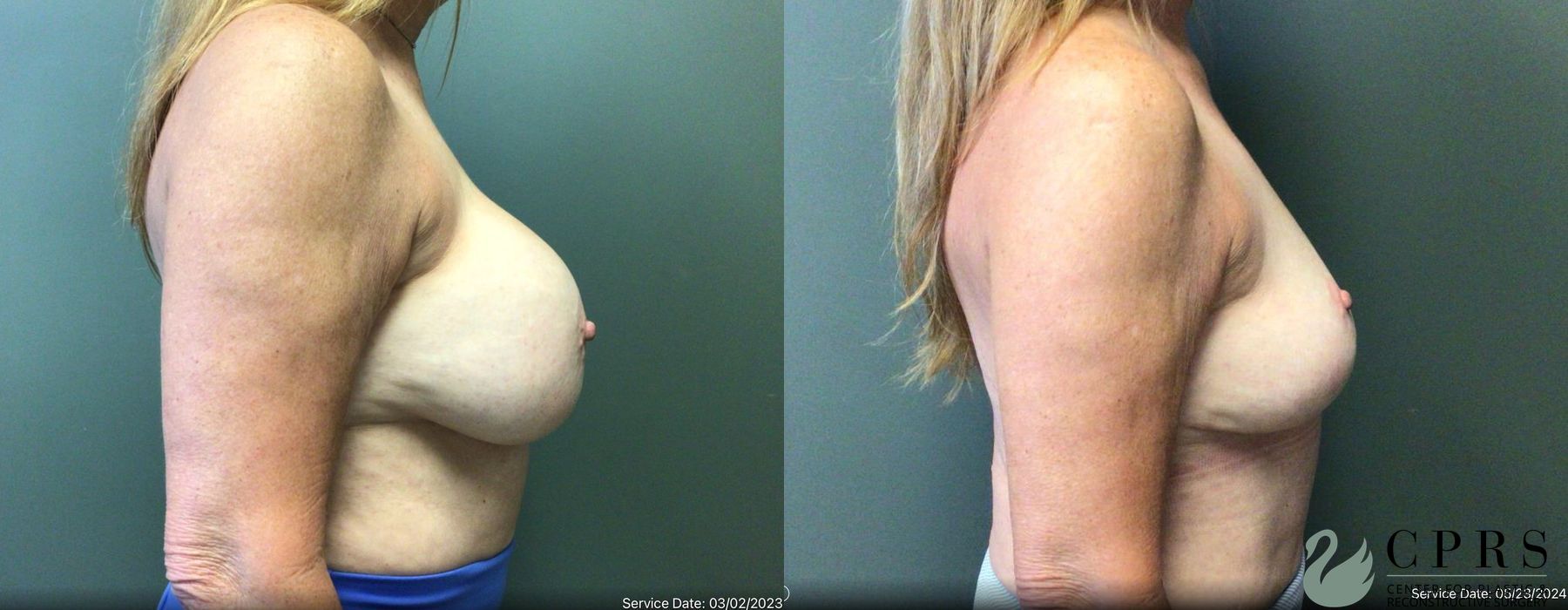 Before photo - Angle 2