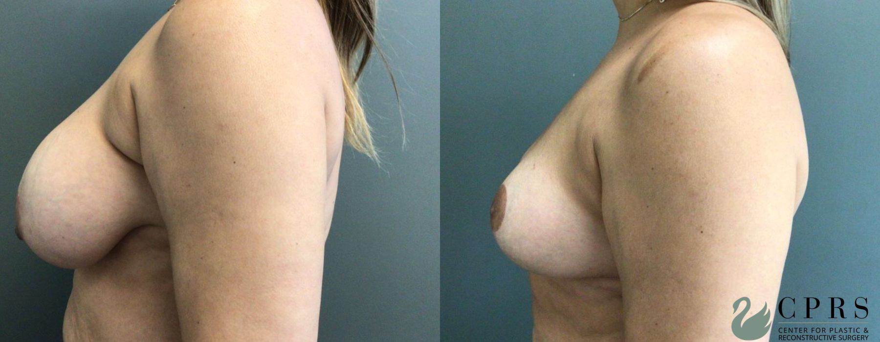 Before photo - Angle 3