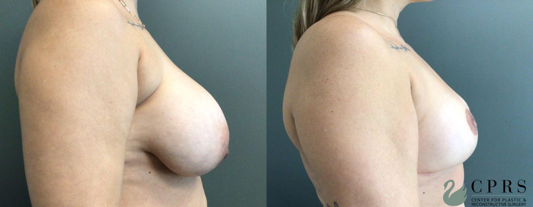 Before photo - Angle 2