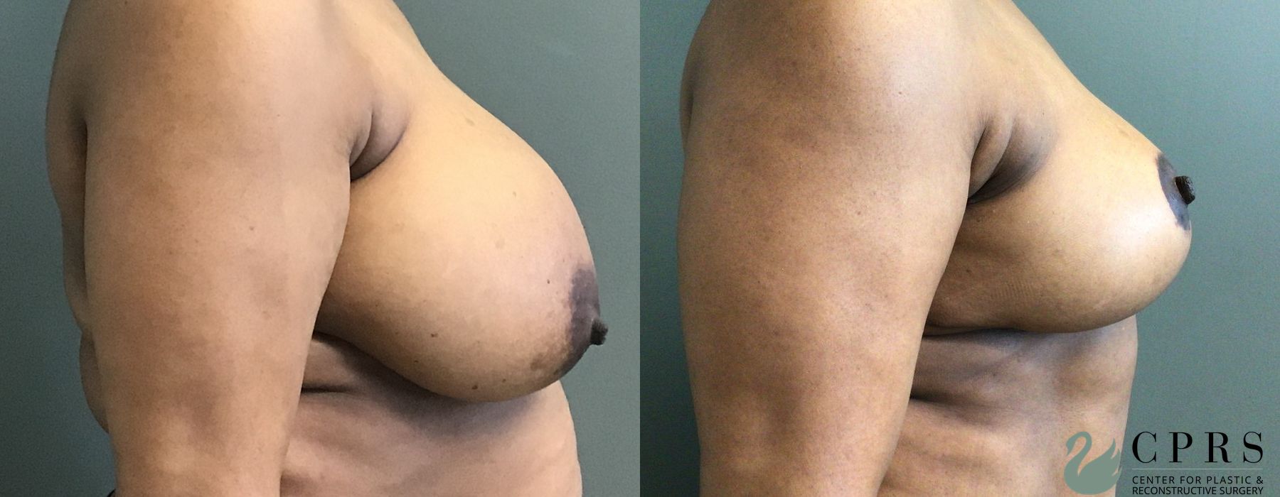 Before photo - Angle 3