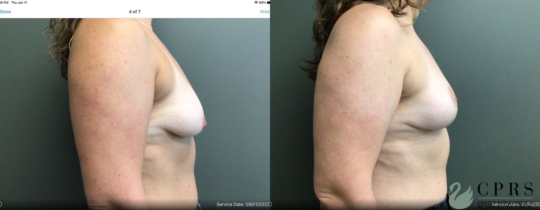 Before photo - Angle 2