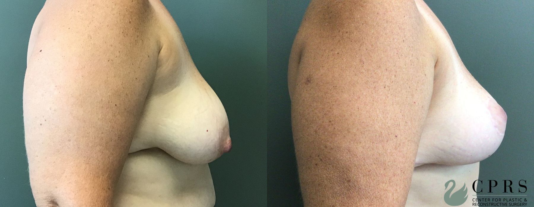 Before photo - Angle 2