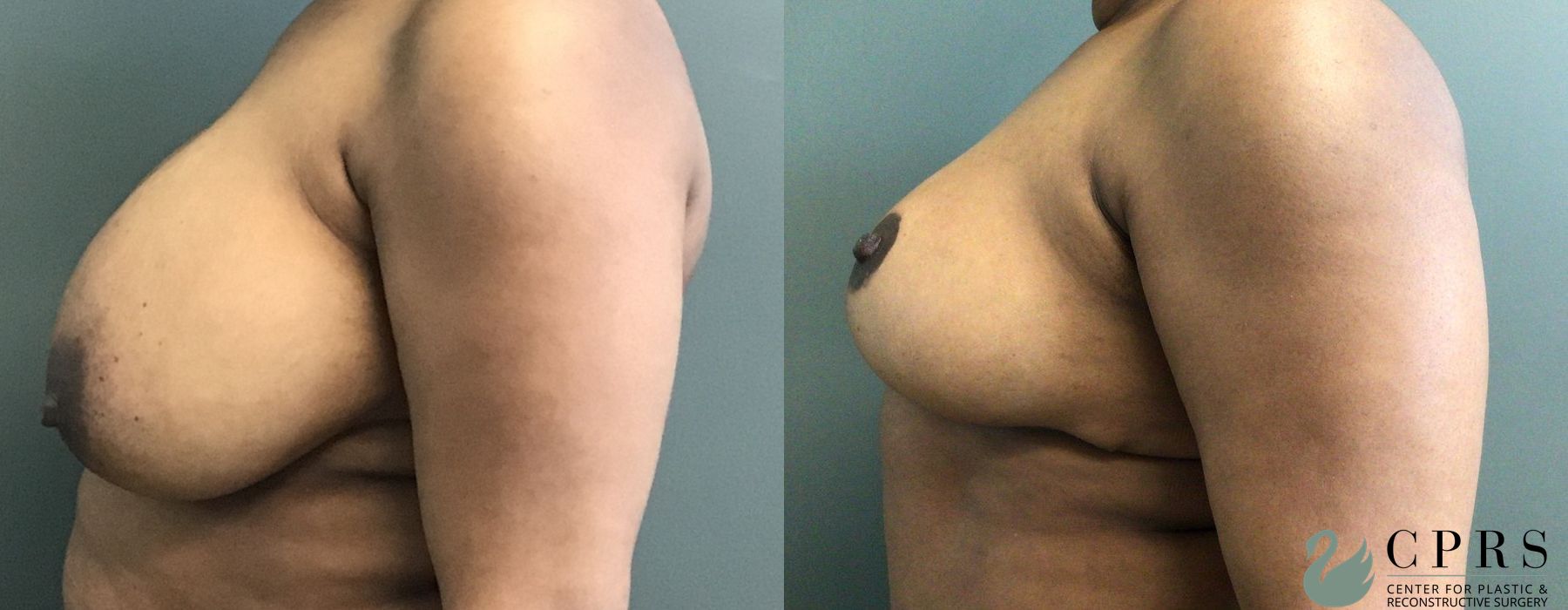 Before photo - Angle 2