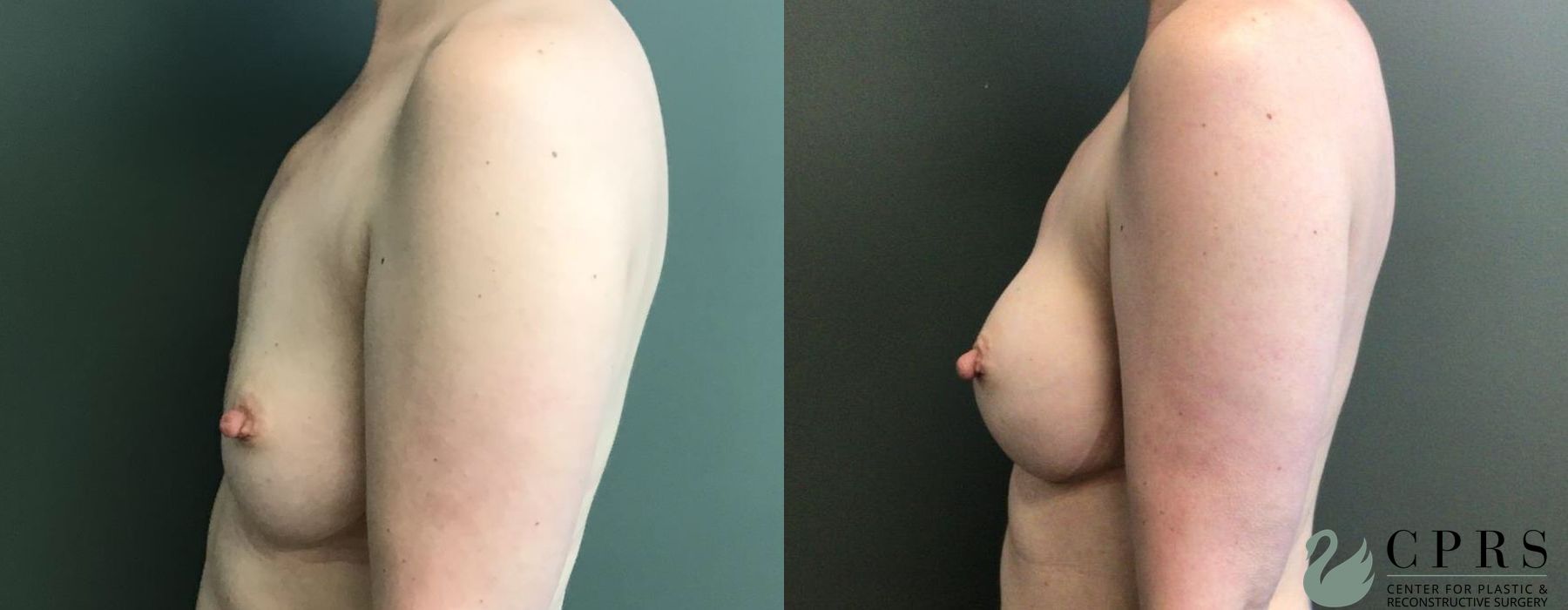 Before photo - Angle 2