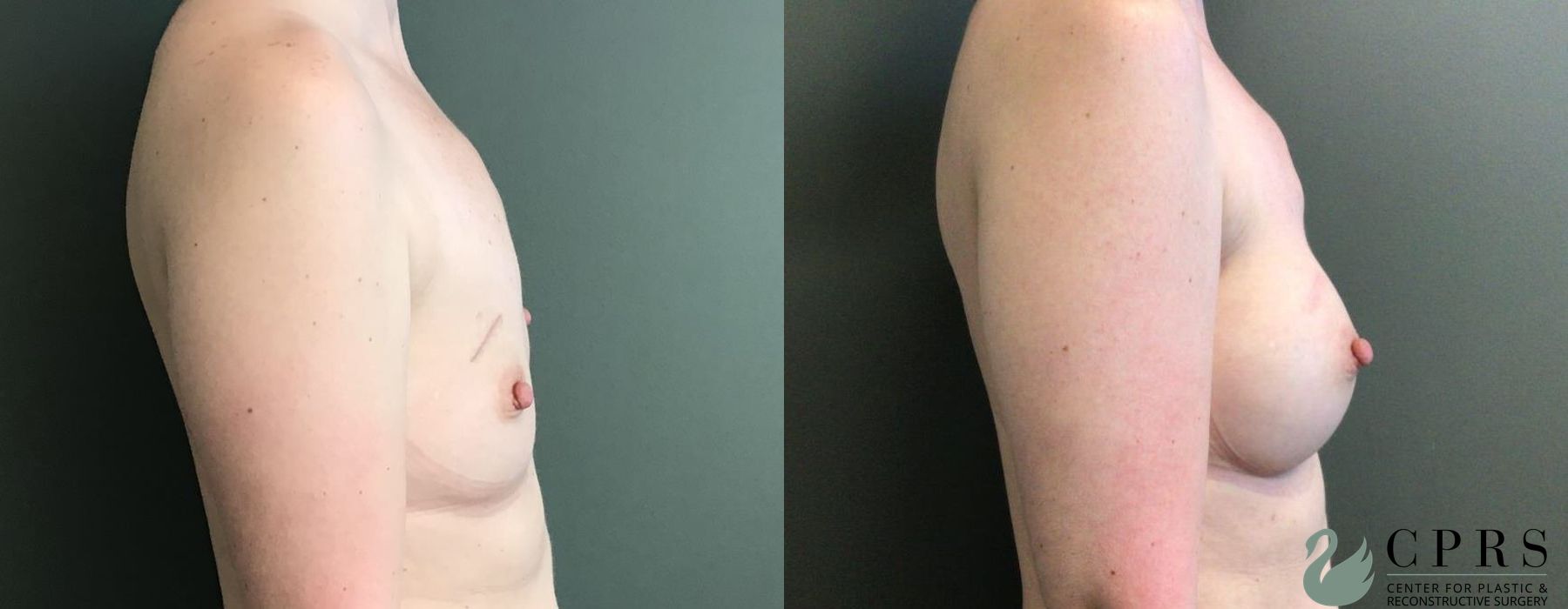 Before photo - Angle 3