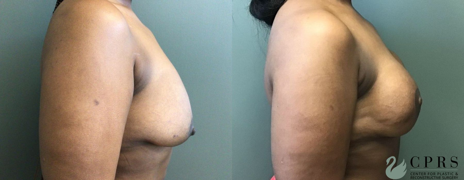 Before photo - Angle 3