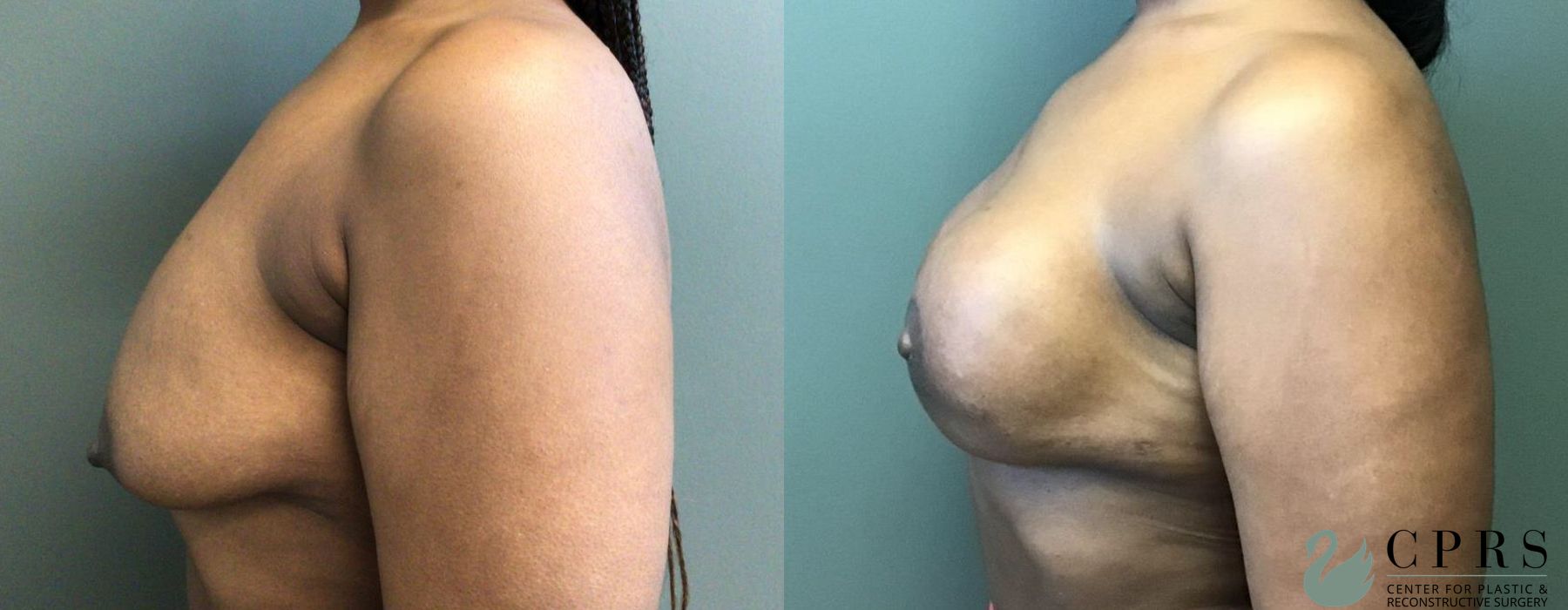 Before photo - Angle 2