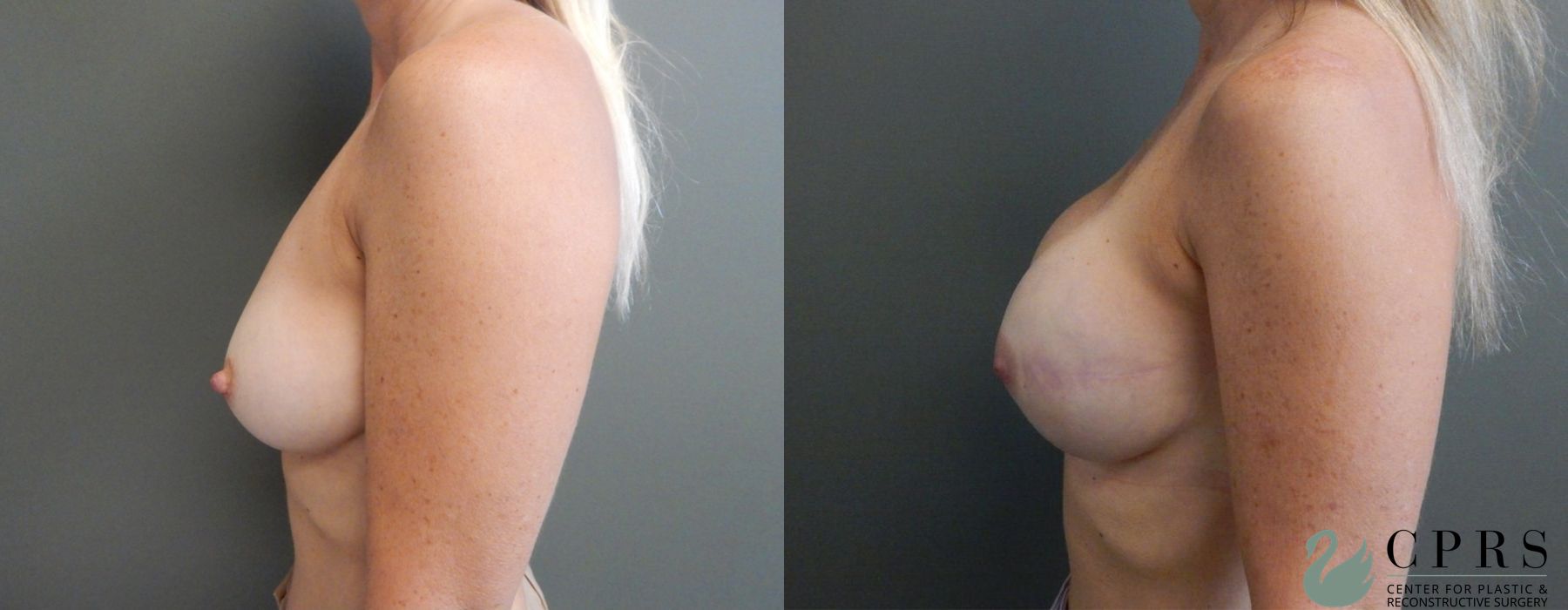 Before photo - Angle 2