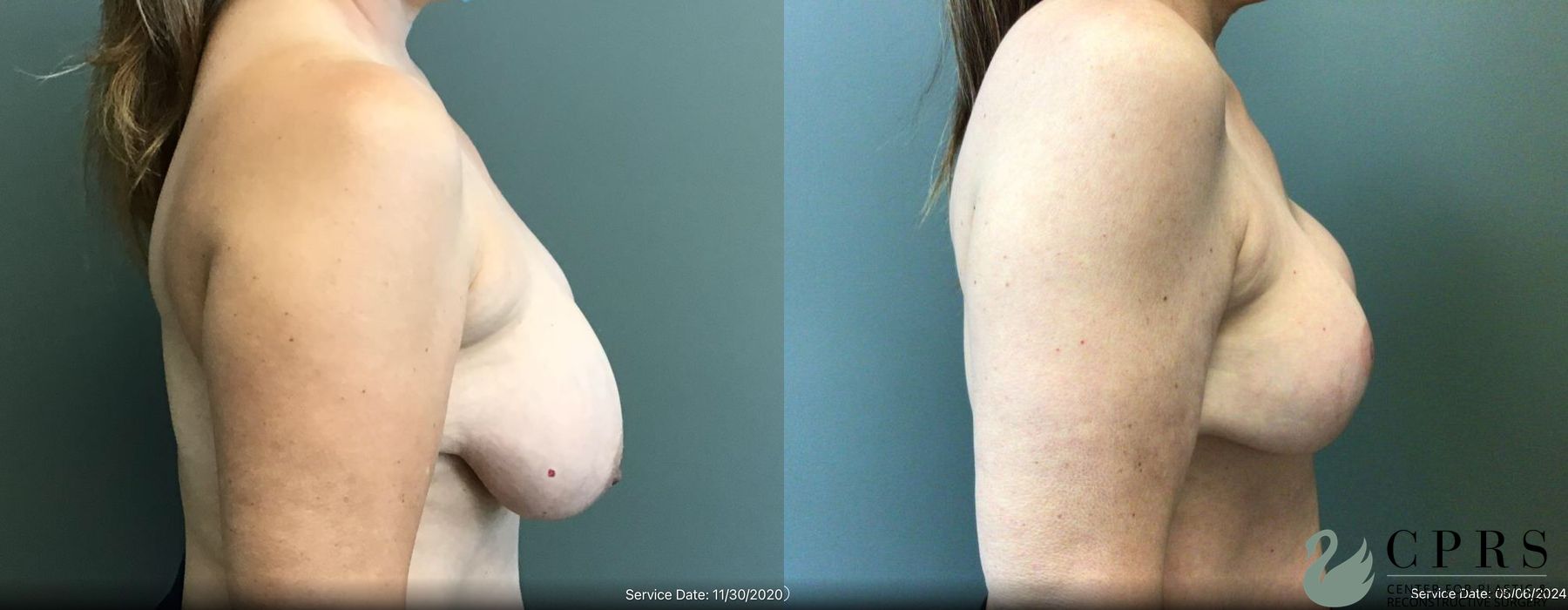 Before photo - Angle 3