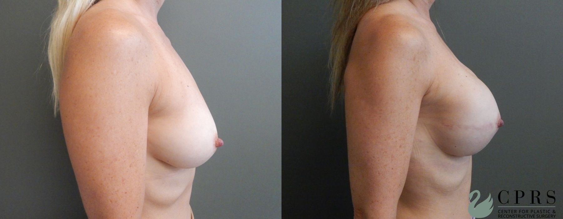 Before photo - Angle 3