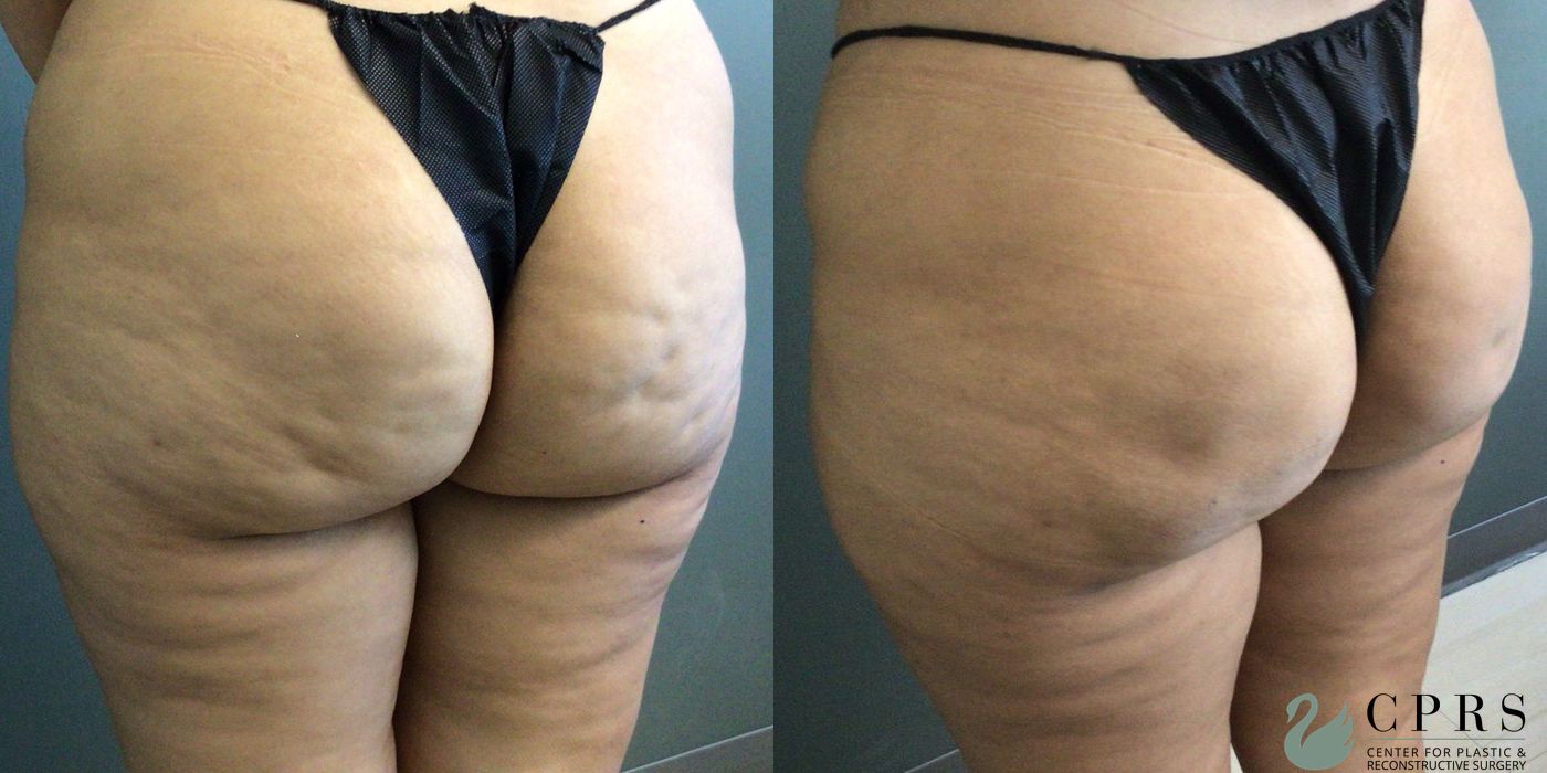 Before photo - Angle 2