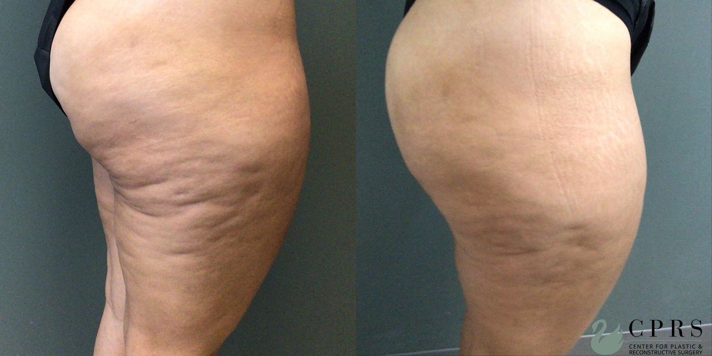 Before photo - Angle 2