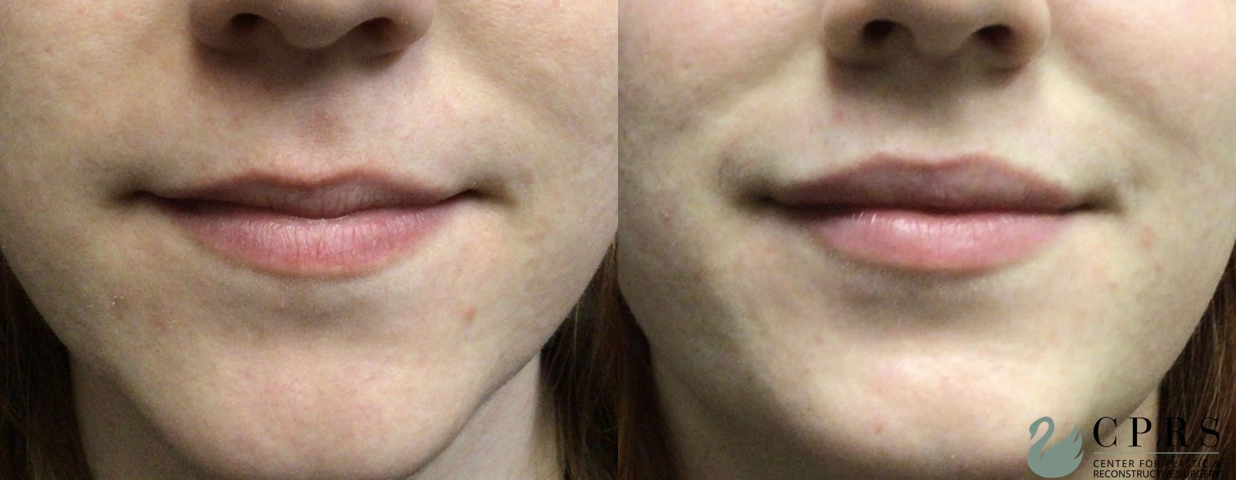 Injectables - Case 239782