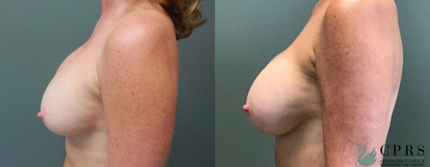 Before photo - Angle 2