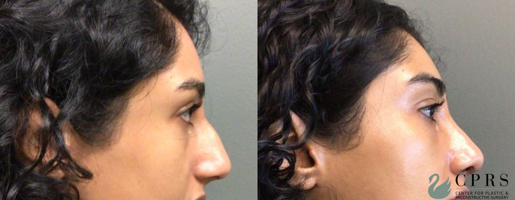 Before photo - Angle 2