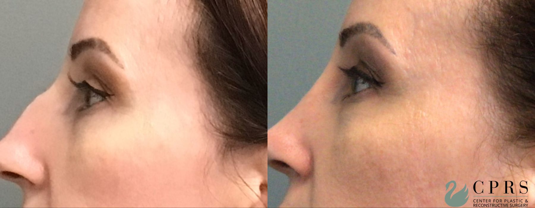 Before photo - Angle 2