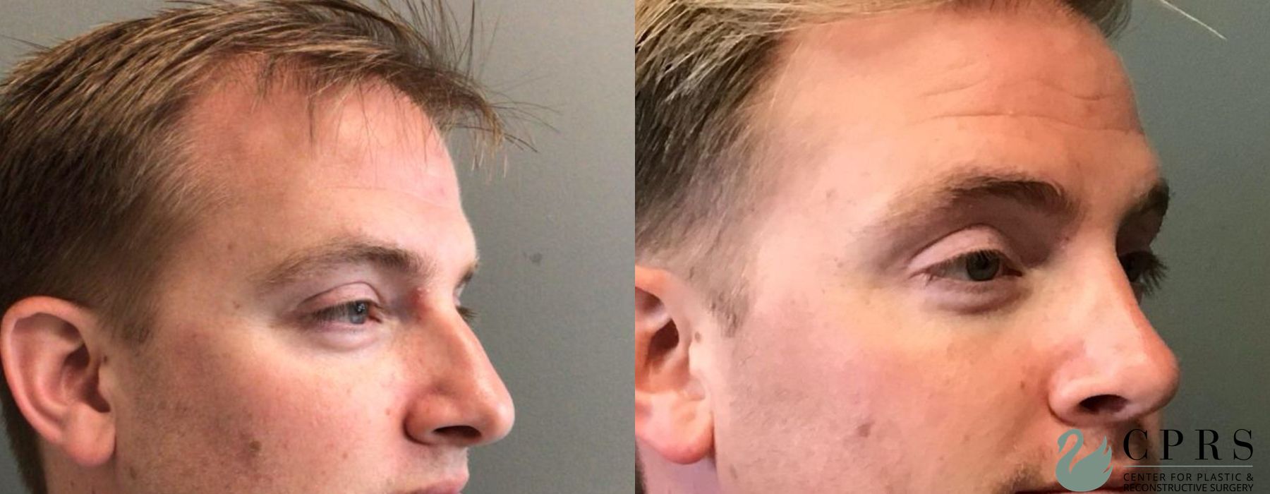 Before photo - Angle 3