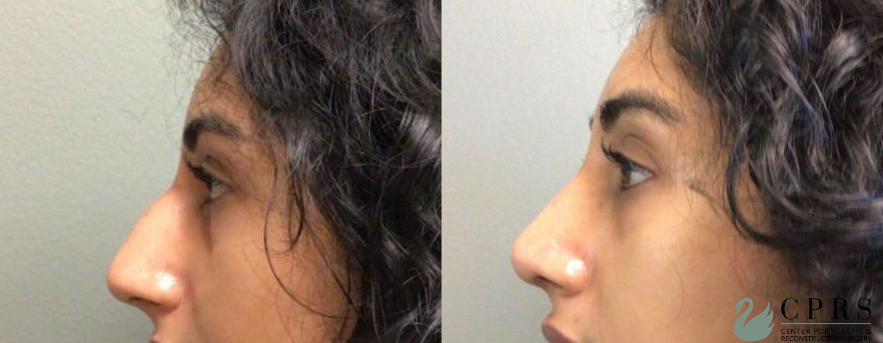 Before photo - Angle 3