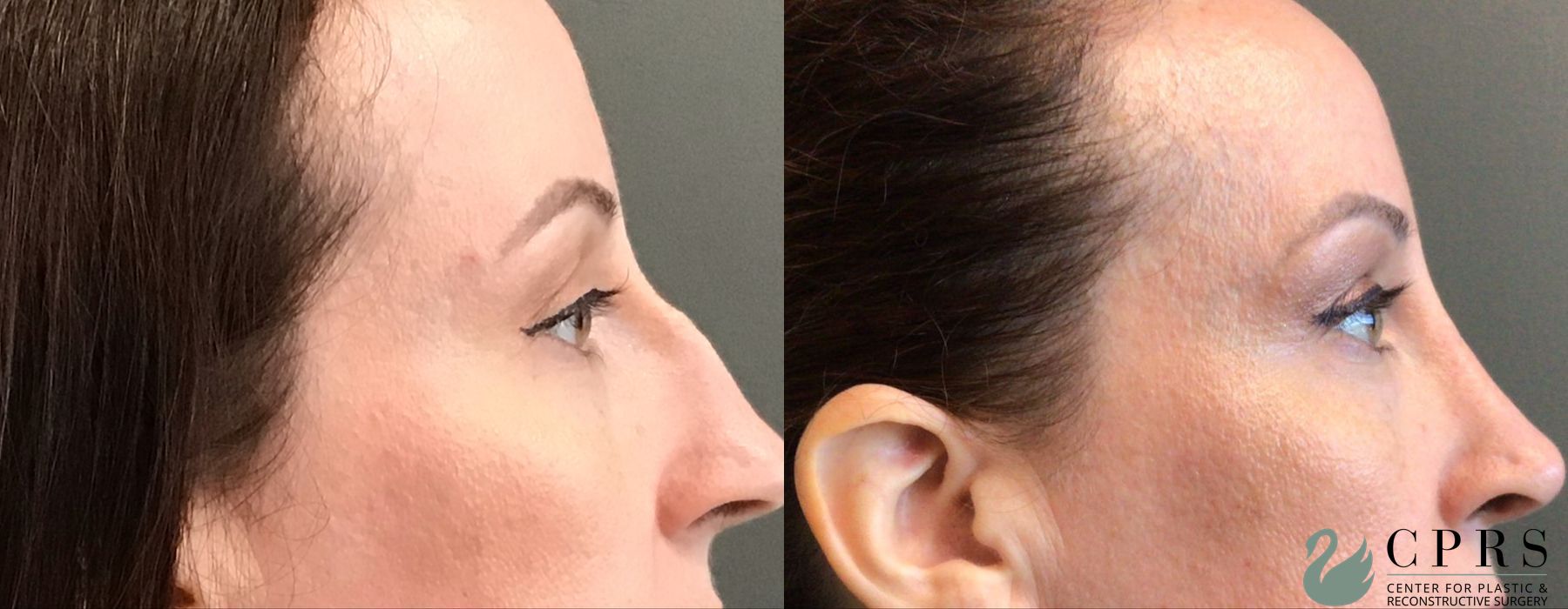 Before photo - Angle 3