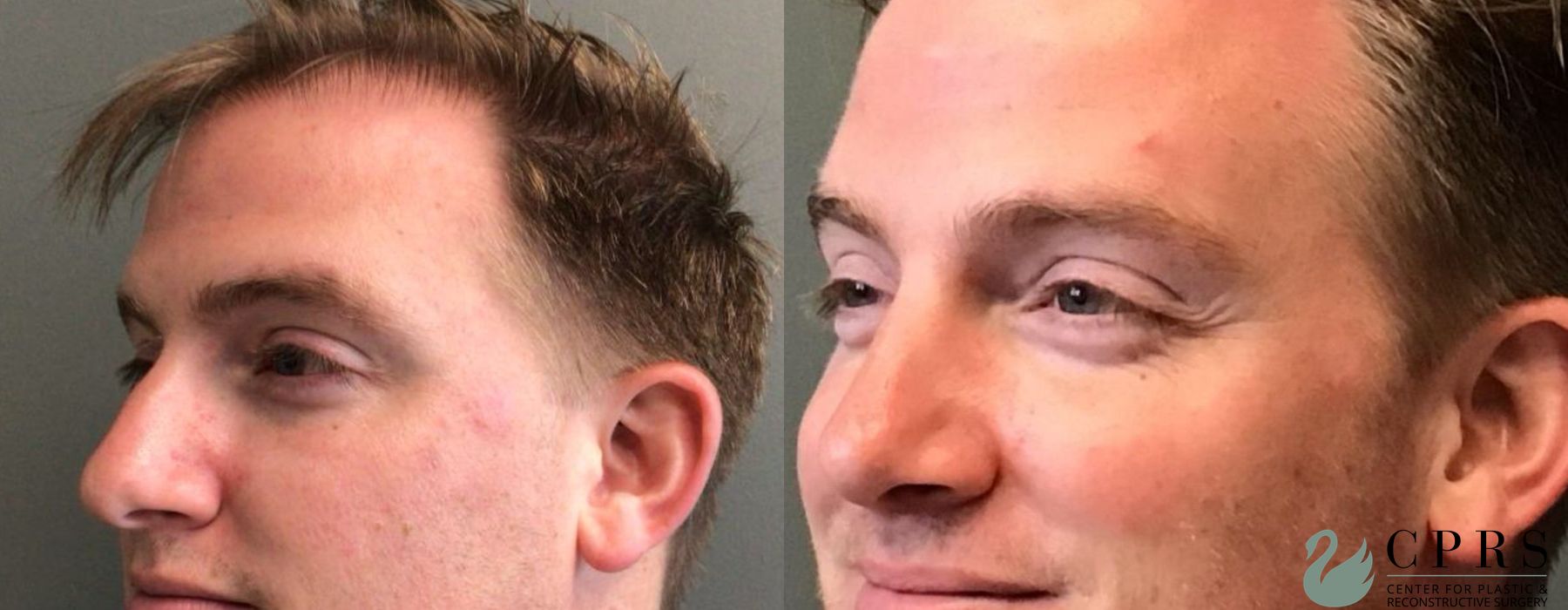 Before photo - Angle 2