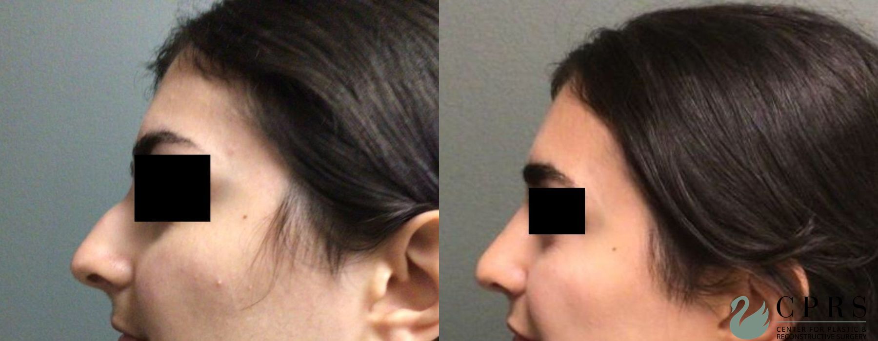 Before photo - Angle 2