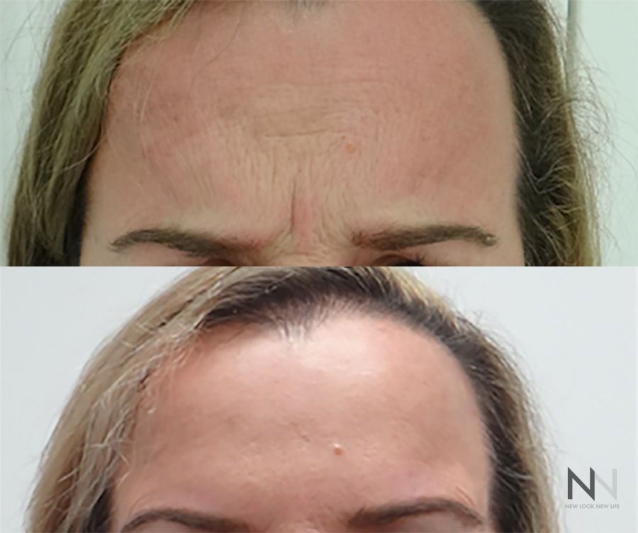 https://www.newlooknewlife.com/