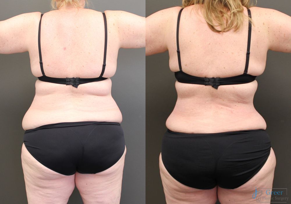 Before photo - Angle 3