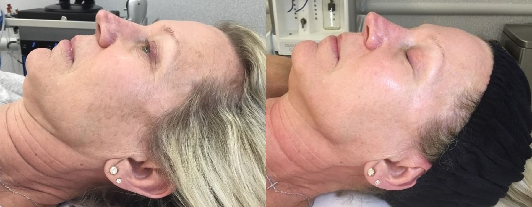 Before photo - Angle 3