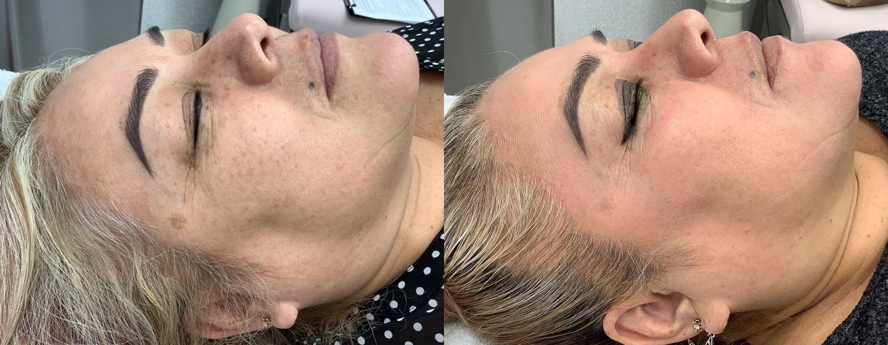 Before photo - Angle 2