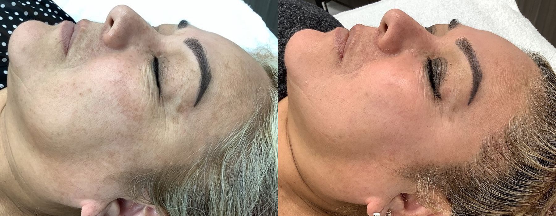 Before photo - Angle 3