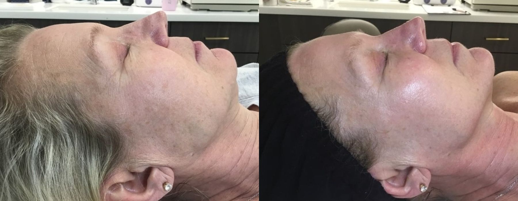 Before photo - Angle 2