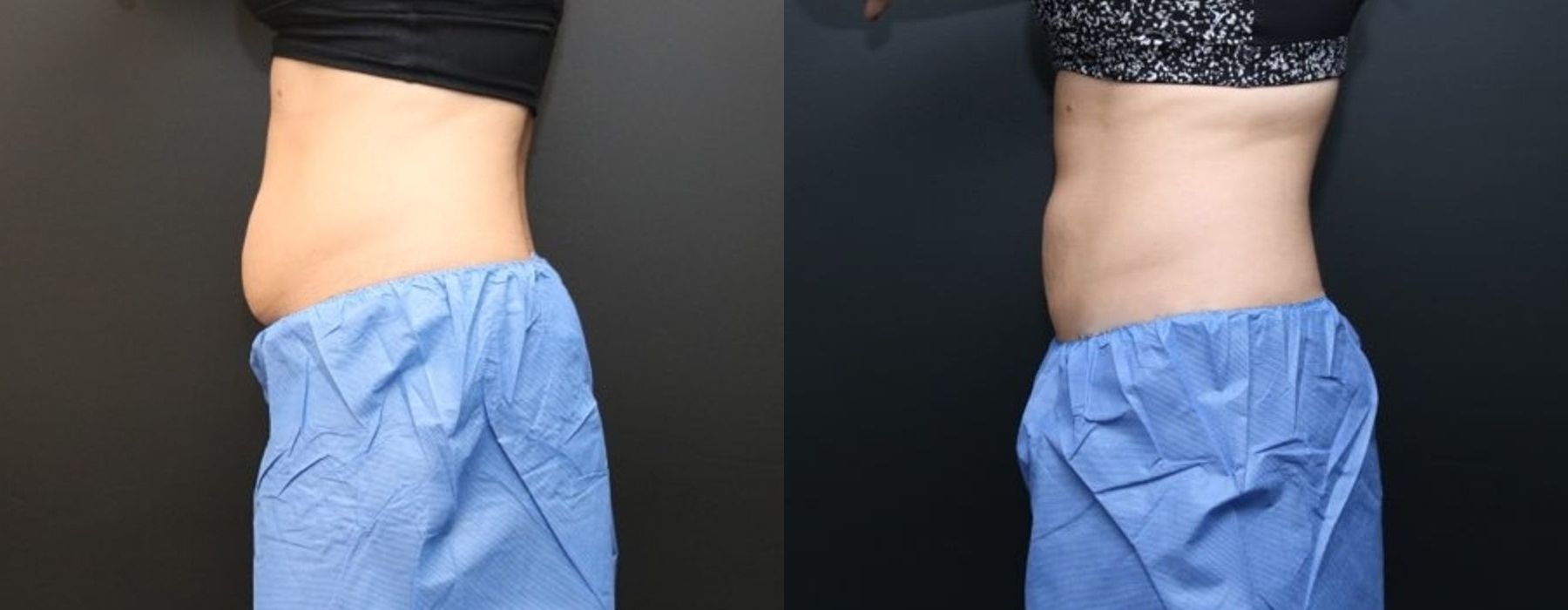 Before photo - Angle 5