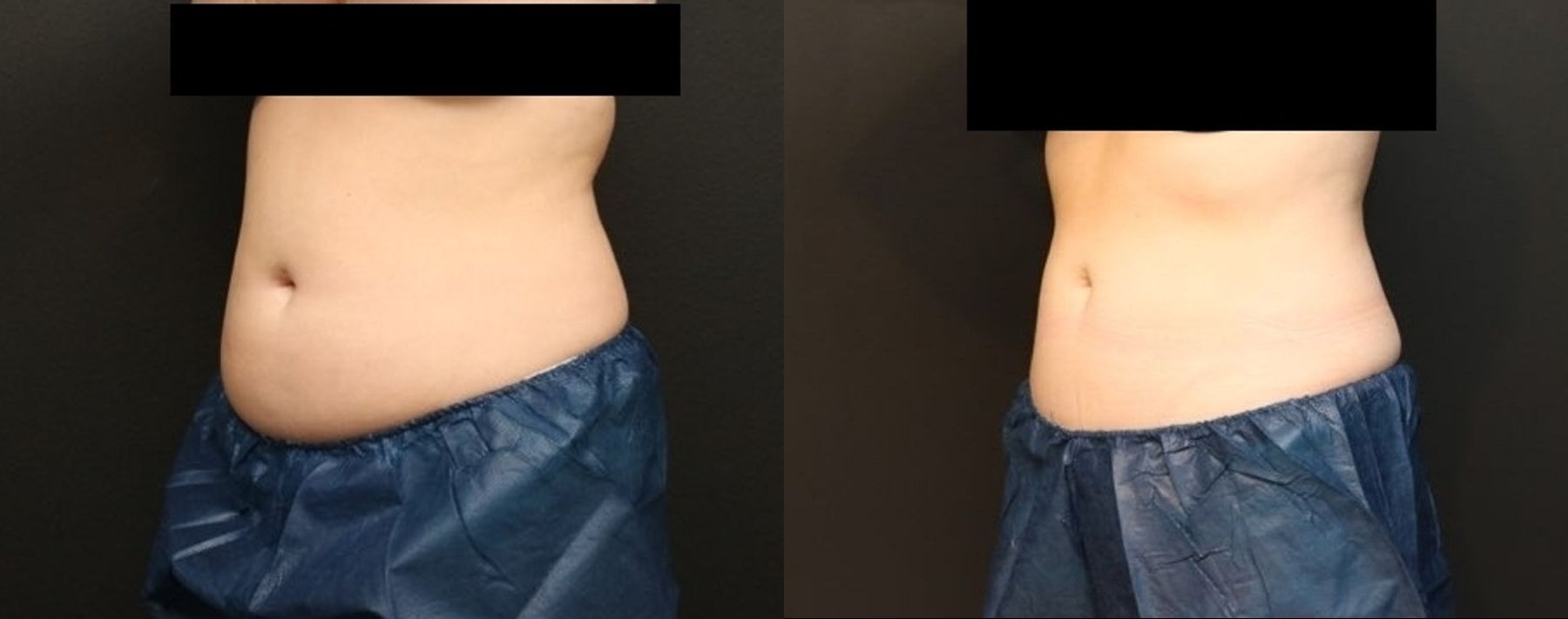 https://yourwebsite.com - Angle 2