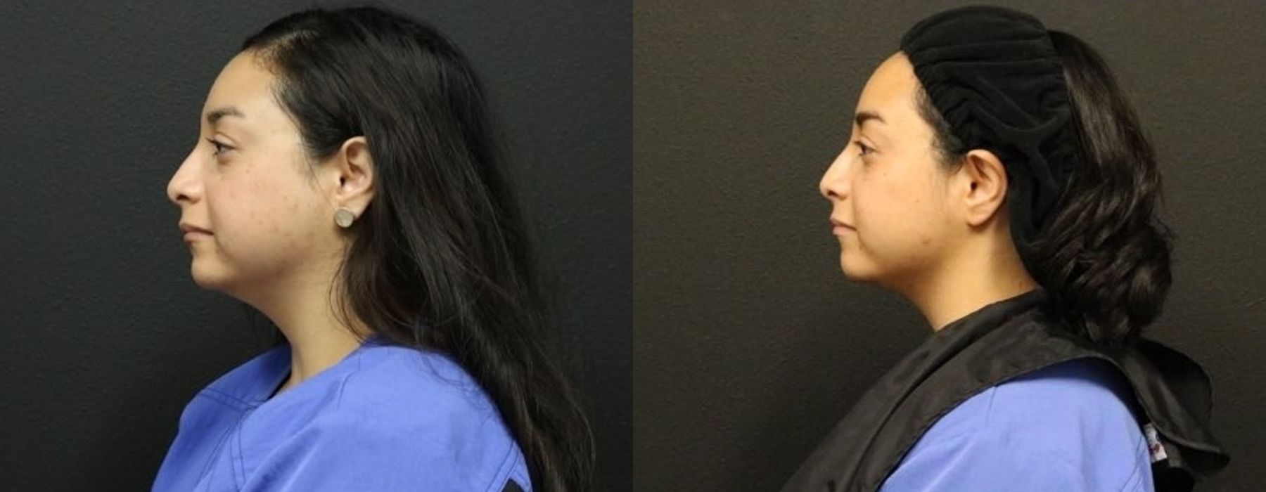 Before photo - Angle 2