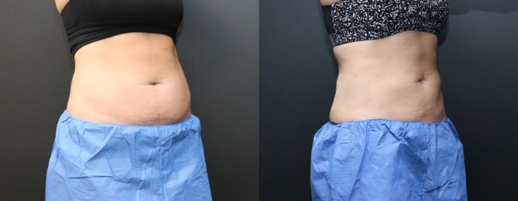 Before photo - Angle 2