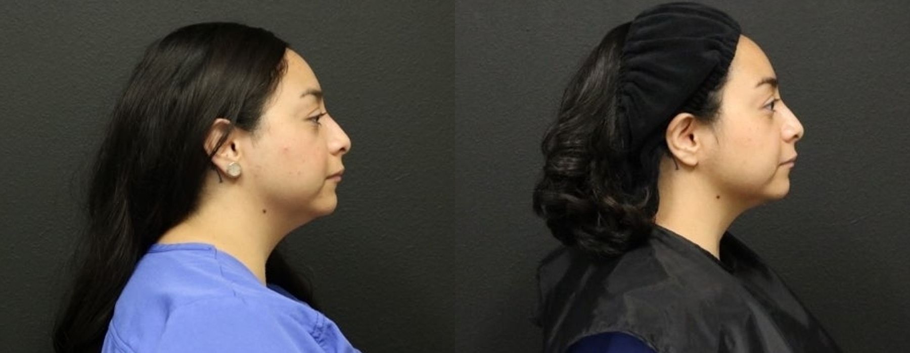 Before photo - Angle 3