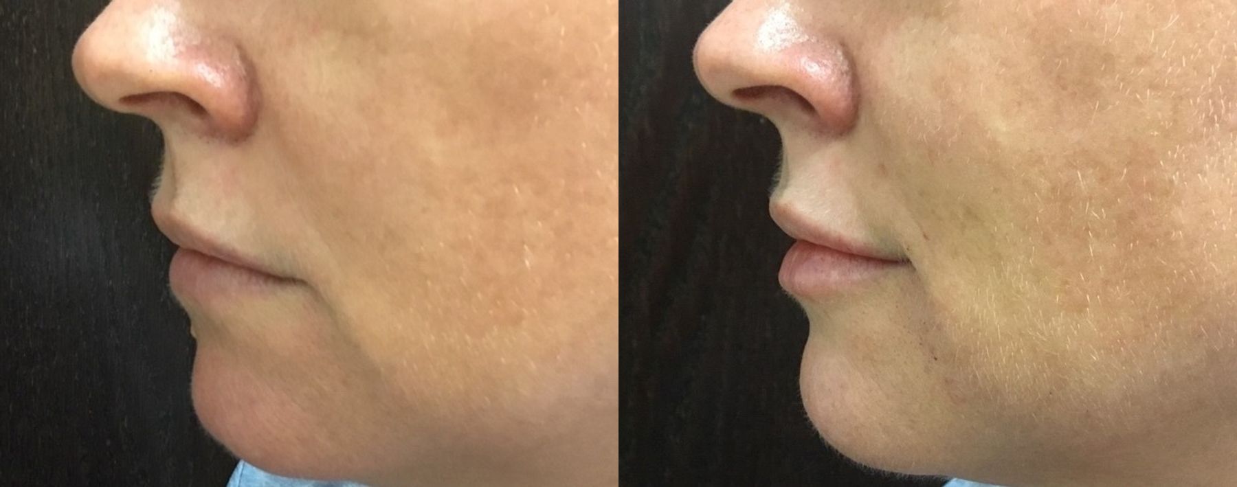 https://yourwebsite.com - Angle 3