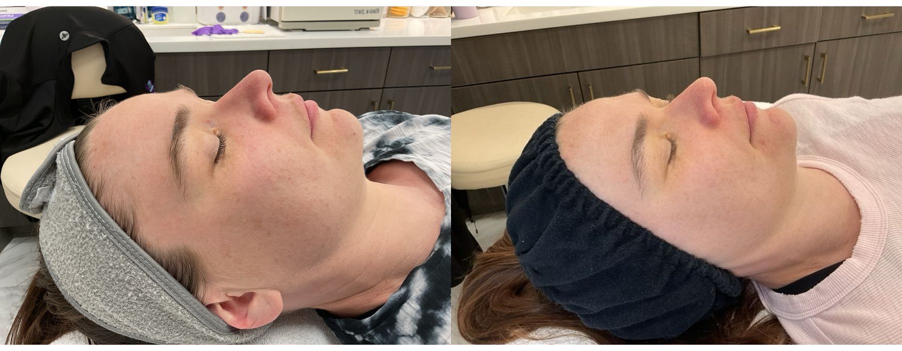 Laser - Pico Genesis - Thumbnail 2