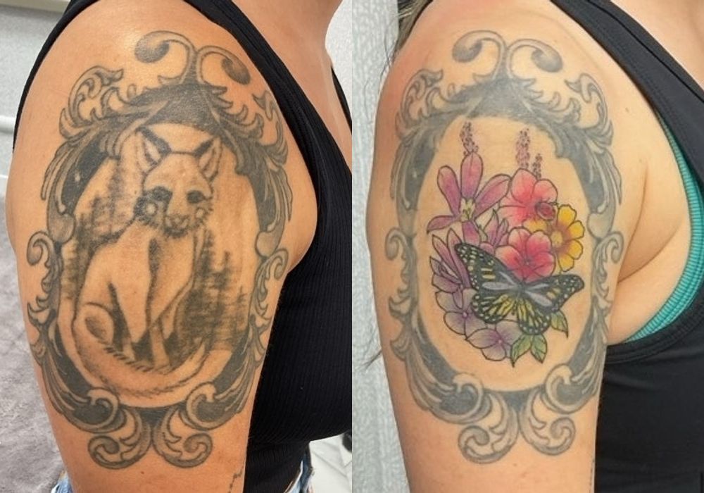 Laser Tattoo Removal - Thumbnail 2