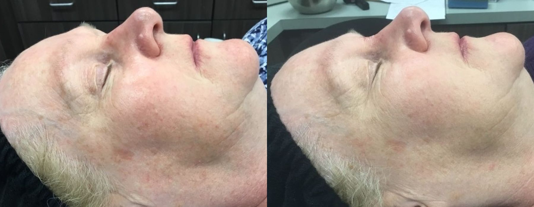 Before photo - Angle 2