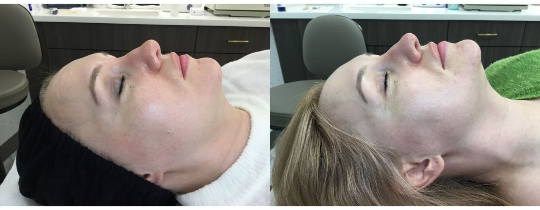 Before photo - Angle 3