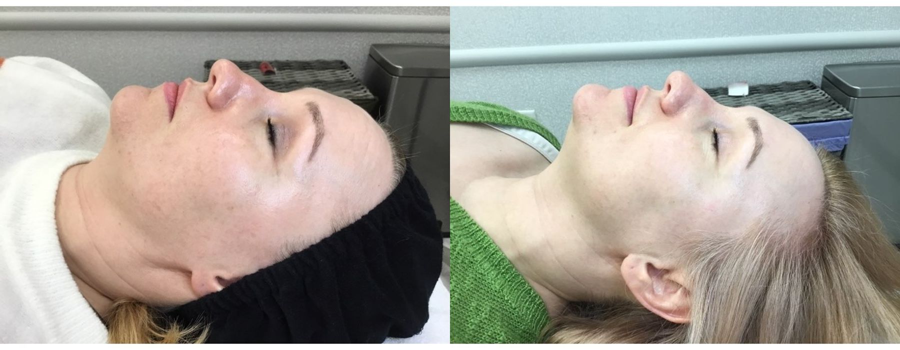 Before photo - Angle 2