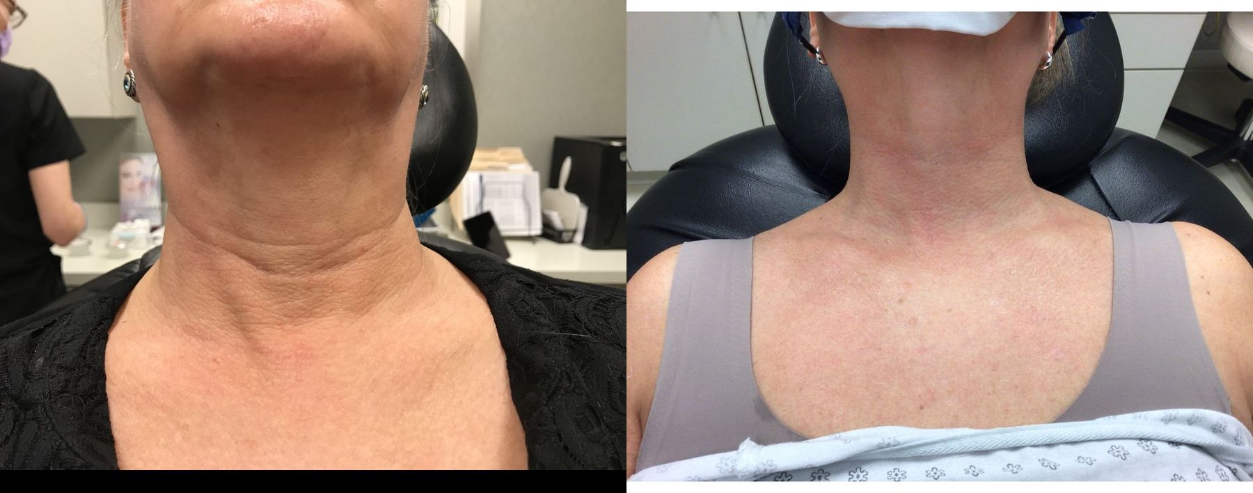 https://yourwebsite.com - Angle 3